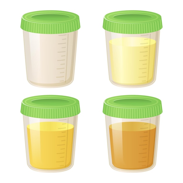 Vettore pee in un set di contenitori di plastica raccolta di fiale per l'analisi delle urine in vari colori da trasparente a giallo illustrazione vettoriale in stile cartone animato piatto