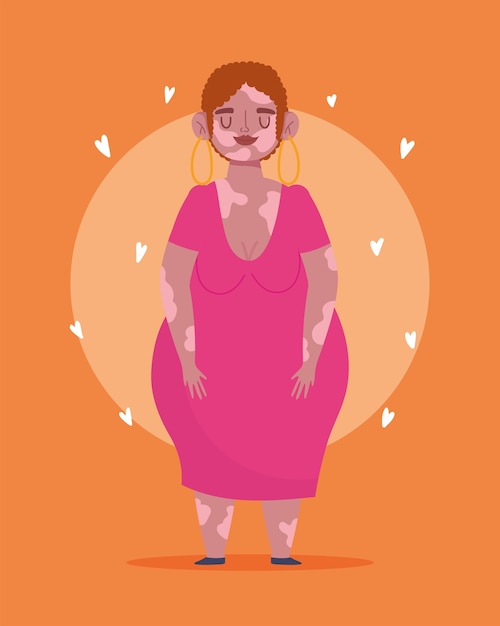 Perfect onvolmaakte cartoonvrouw met een grote maat met vitiligo