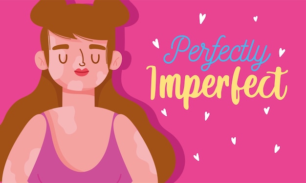 Perfectly imperfect, cartoon woman with vitiligo disease