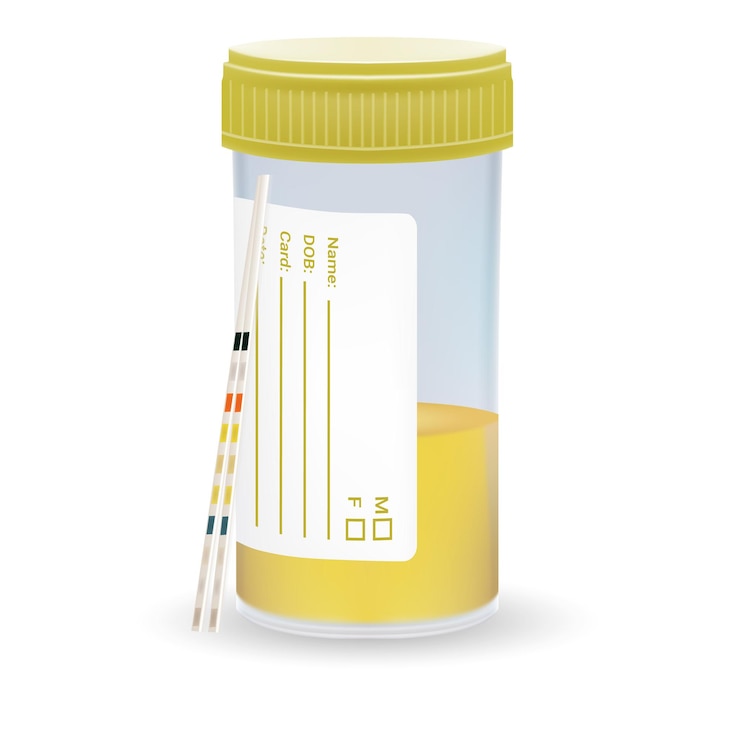 Вектор ph test strips лакмусовая бумага и моча в тестовой банке, изолированные на белом фоне реалистичный вектор