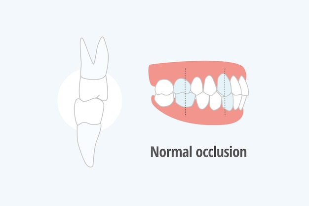 pictogram tandheelkundig probleem vector illustratie Normale occlusie lateraal