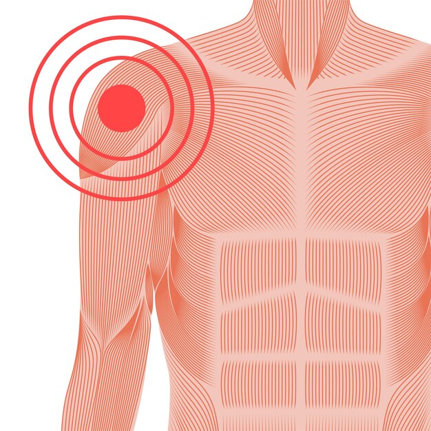 Pijn in schouder of schouderblad. Gespierd systeem man silhouet. Gewrichten en kraakbeen