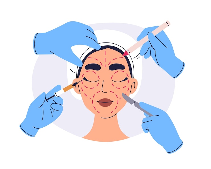 Vector plastic surgery facial cosmetic lifting beauty enhancement face with line markings for aesthetic procedure antiaging contour correction flat vector illustration isolated on white background