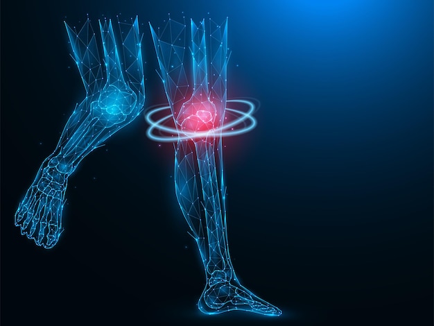polygonal vector illustration of human legs painful and inflamed knee sick knee recovery concept