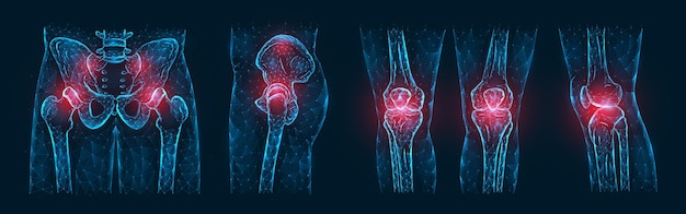 Vector polygonal vector illustration of pain or inflammation of the bones in the pelvis, hip joint, and knee joints isolated