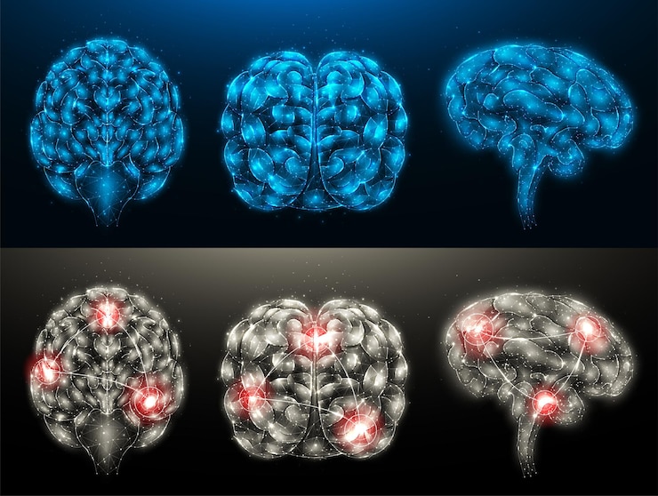 Vector polygonal vector illustrations of a healthy brain and a diseased brain with foci of inflammation