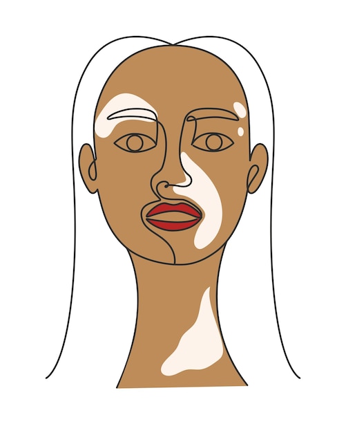 Portrait woman with vitiligo lineart vector illustration Adult beautiful girl with skin pigmentation