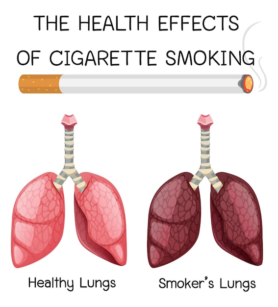 Poster sugli effetti sulla salute del fumo di sigaretta