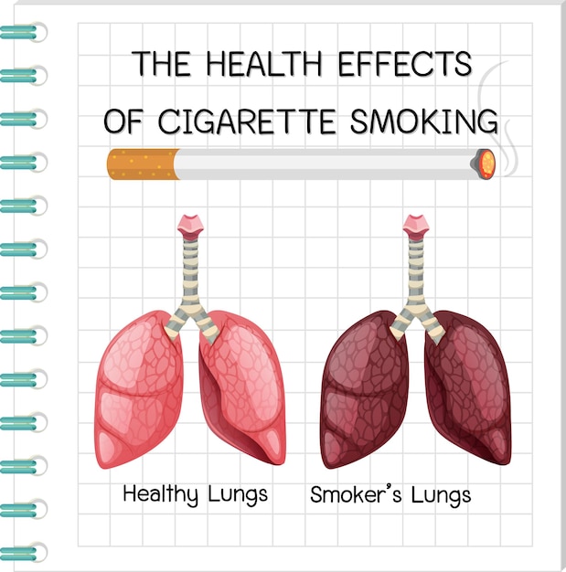 Poster over gezondheidseffecten van het roken van sigaretten