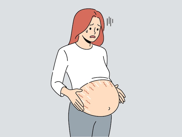 腹にストレッチ マークを持つ妊娠中の女性