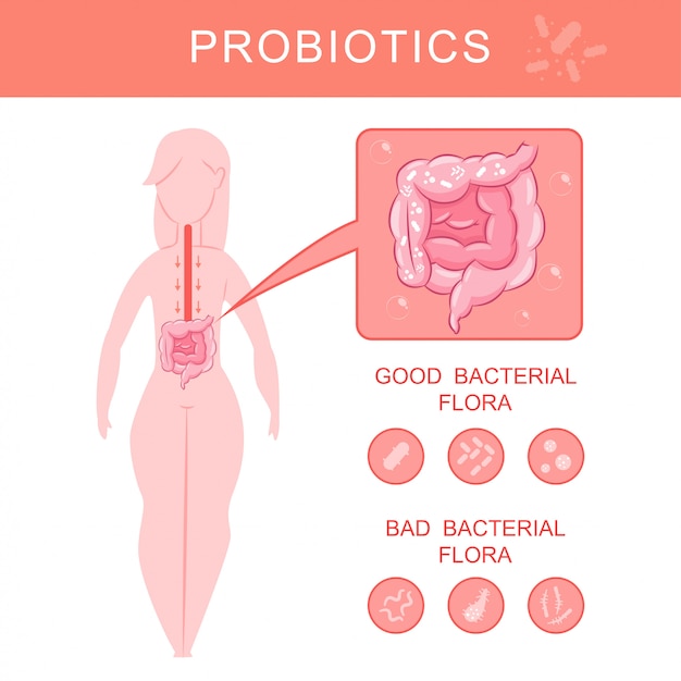 Probiotics infographics with woman silhouette and gut with good and bad bacterial flora vector cartoon illustration.