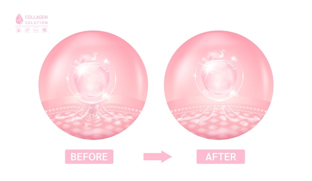 Процесс омоложения кожи с помощью коллагена розового гиалуроновая кислота витаминный комплекс