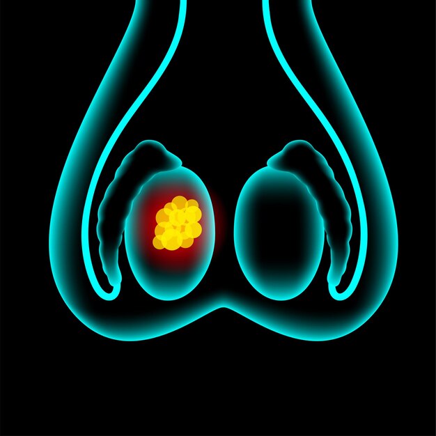 Vector prostate cancer concept