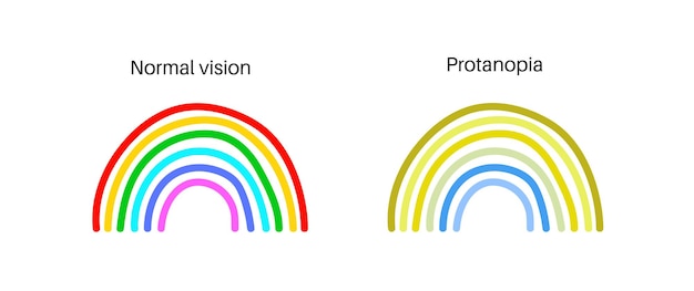 Vettore protanomalia e protanopia