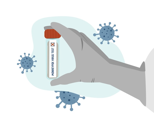 Vector reageerbuis met positieve test monkeypox-virus concept gehandschoende hand houdt een geïnfecteerd bloedmonster vast virusdeeltjes vectorillustratie plat