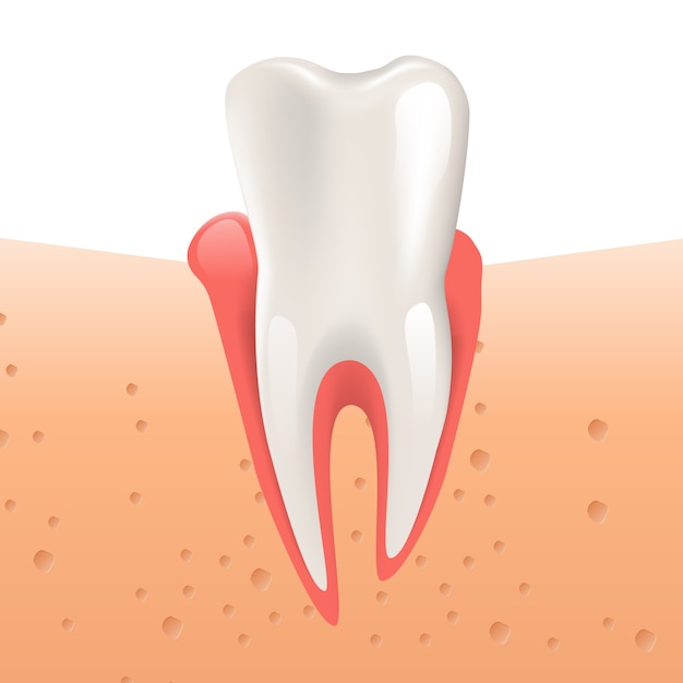 Realistic Illustration Gingivitis Healthy Tooth