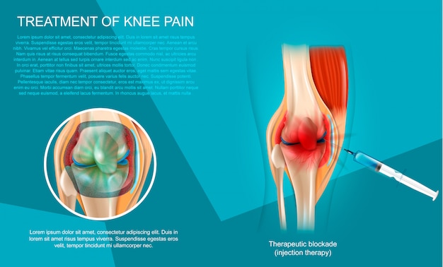 realistic illustration treatment of knee pain