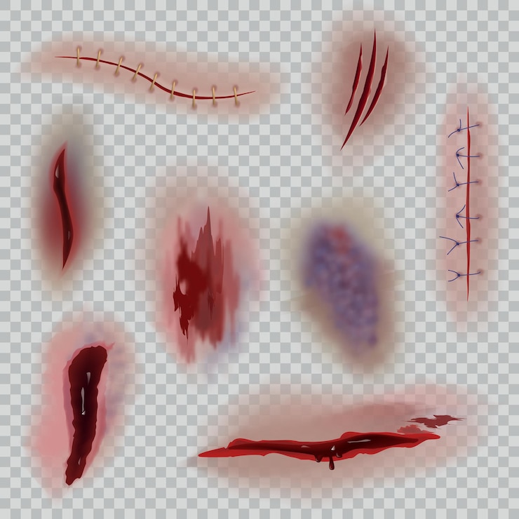 Vector 현실적인 상처. 흉터, 수술 바늘 및 타박상, 피부 절개. 피 묻은 상처 할로윈 또는 의료 근접 텍스처 벡터 절연 투명 배경에 설정