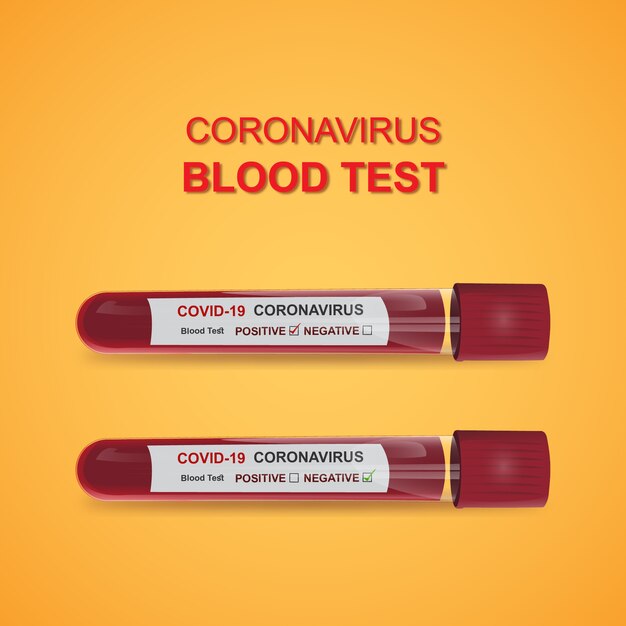 Realistisch coronavirus-bloedtestlaboratorium