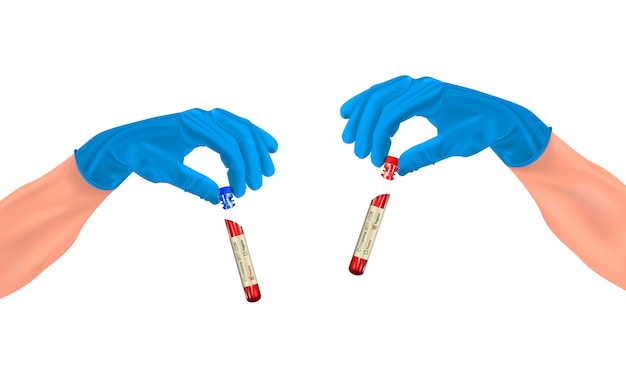 Vector realistische reageerbuis in de hand met een coronavirus-test (2019-ncov) op een geïsoleerde achtergrond, concept van een positief en negatief resultaat op covid-2019, illustratie