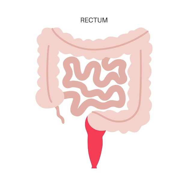 Rectum colon poster Large intestine in the human body Gastrointestinal disease diagnostic and treatment in gastroenterology clinic Digestive tract examination of bowel vector illustration