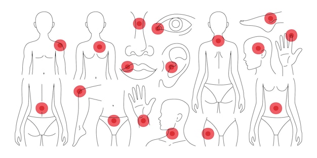 인체에서 다른 통증 위치와 염증 과정을 나타내는 은 핀트 세트