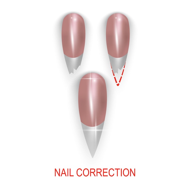 Vector restauratie van een gebroken nagel, nagelsalon, vectorillustratie