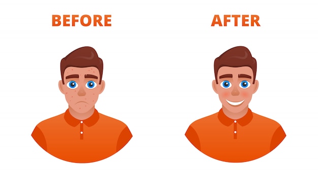 Vector the result of acne treatment. a sad guy with acne becomes happy without.