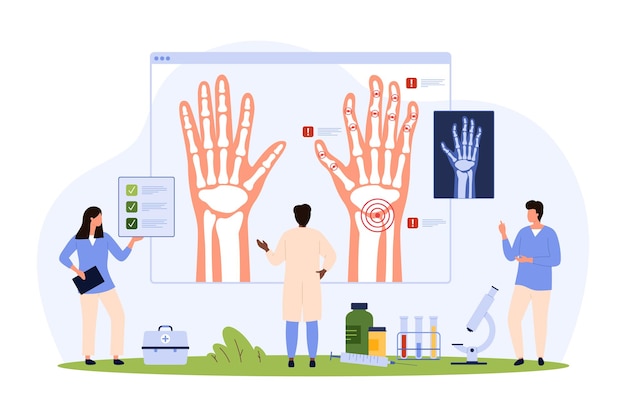 Artrite reumatoide osteoartrite del polso e delle dita diagnosi da parte di persone piccole