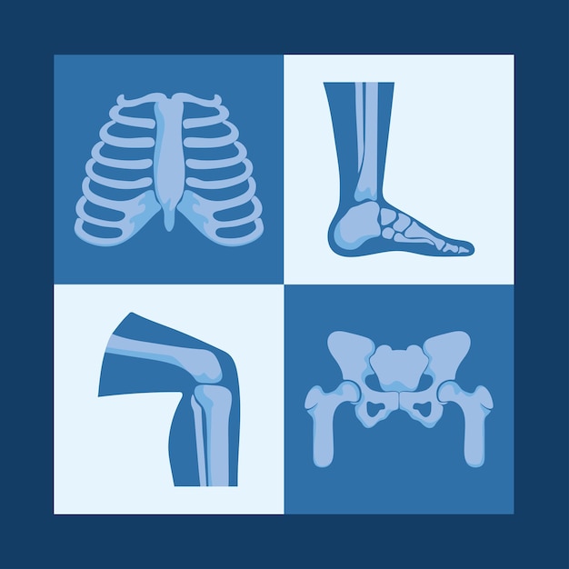 Rheumatology bones designs