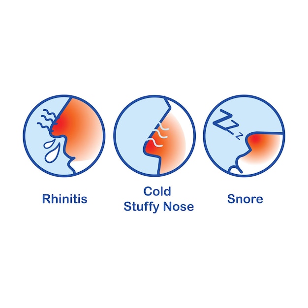 Rhinitis Cold Stuffy Nose Snore