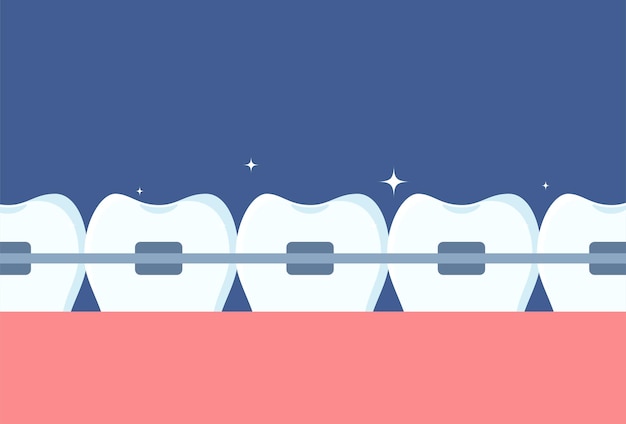 Row of teeth with braces on them Orthodontics and aesthetic dentistry medicine