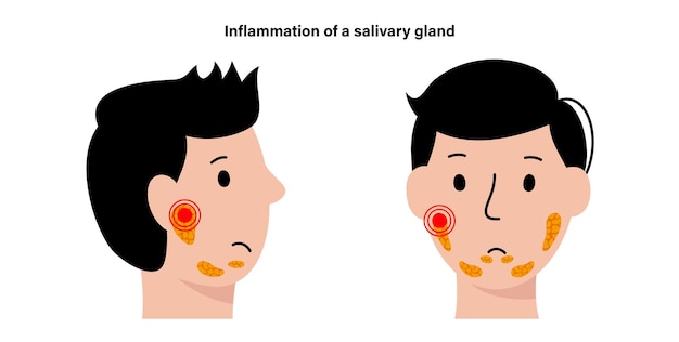 Concetto di ghiandola salivare