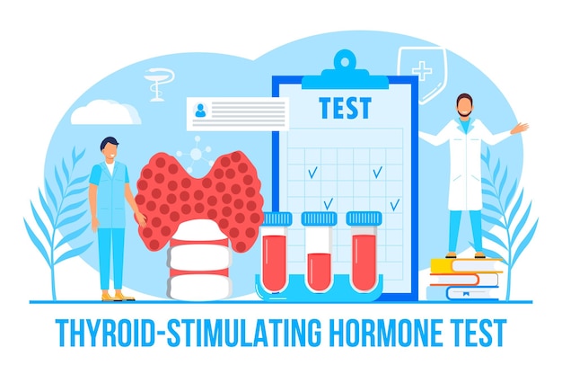 Schildklierstimulerend hormoon testconcept vector voor medische website Hypothyreoïdie concept vector Endocrinologen diagnosticeren en behandelen menselijke schildklier Specialisten maken bloedonderzoek hormonen