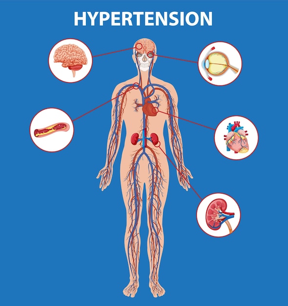 Science education human anatomy and hypertension effects