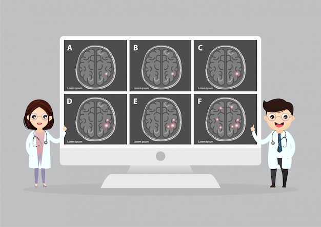 Scientific medical illustration of human brain stroke illustration