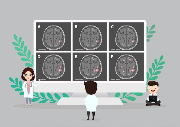 Vector scientific medical illustration of human brain stroke