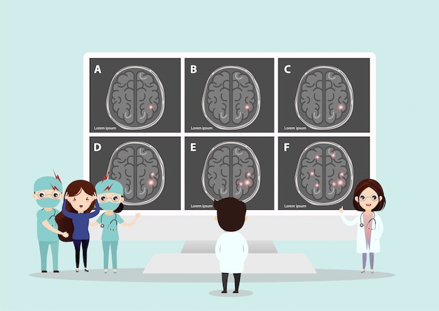 벡터 인간의 뇌졸중의 과학적인 의료 일러스트