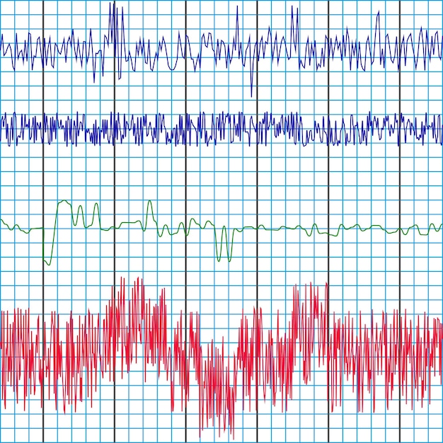 Vector screen recording polygraph