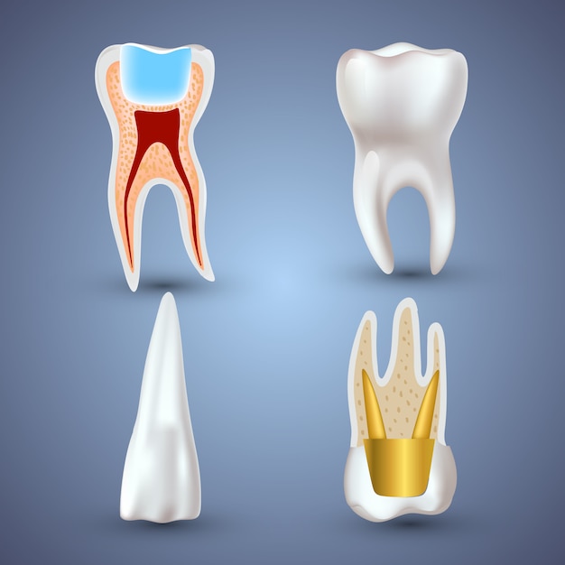 Vettore insieme del dente pulito e sporco realistico 3d isolato. concetto di salute dentale. cura orale, restauro dei denti