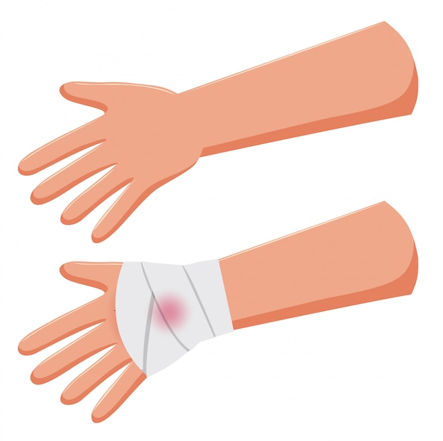 Set of arms and hand bandage