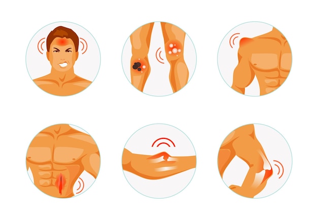 Vector set body parts with various types of injuries. concussion, burn, bruise, injury, fracture