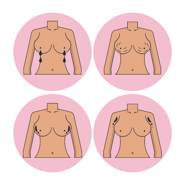 Vector set of breast cancer icons