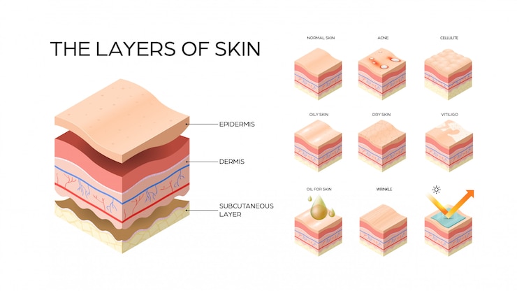 Vector set different types skin layers cross-section of human skin structure skincare medical concept flat horizontal