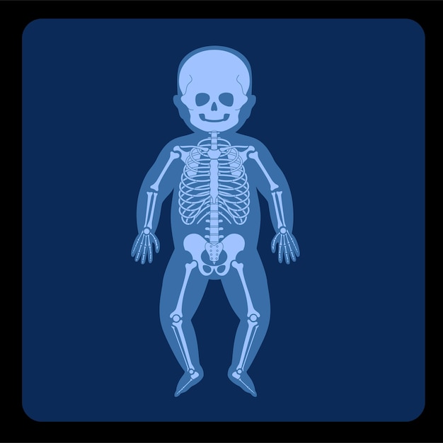 Set di anatomia dello scheletro del bambino umano davanti alla vista a raggi x. dolore, frattura o infiammazione