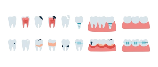 ベクトル 歯の病気や口腔の問題を持つ歯のセット
