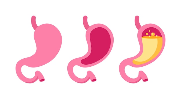 Set of stylized stomach icons in shades of pink depicting various states of stomach health