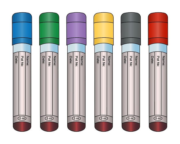 Set di provette con esami del sangue dei pazienti in stile cartone animato