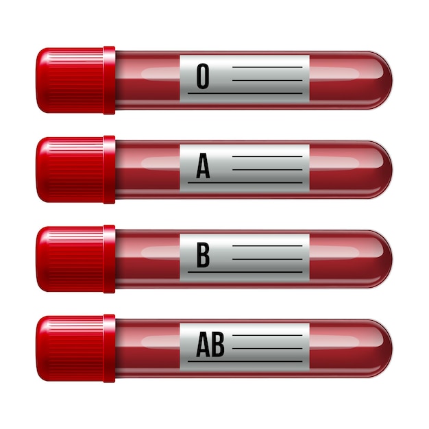 Set van glaswerk buis gevuld bloed met verschillende karakters menselijke bloedgroep Vectorillustratie