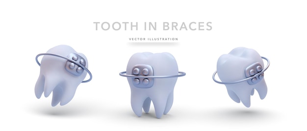 Set van verschillende realistische tanden in stijl geïsoleerd op witte achtergrond Vector illustratie